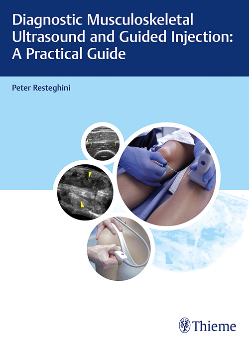Guide to Musculoskeletal Ultrasound and Injections